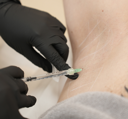 Botox hyperhidrosis treatment for excessive sweating in Abu Dhabi
