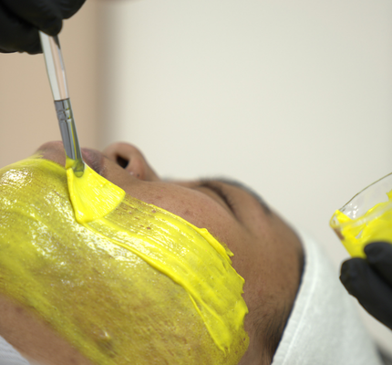Medical grade chemical peel treatment for skin rejuvenation in Abu Dhabi