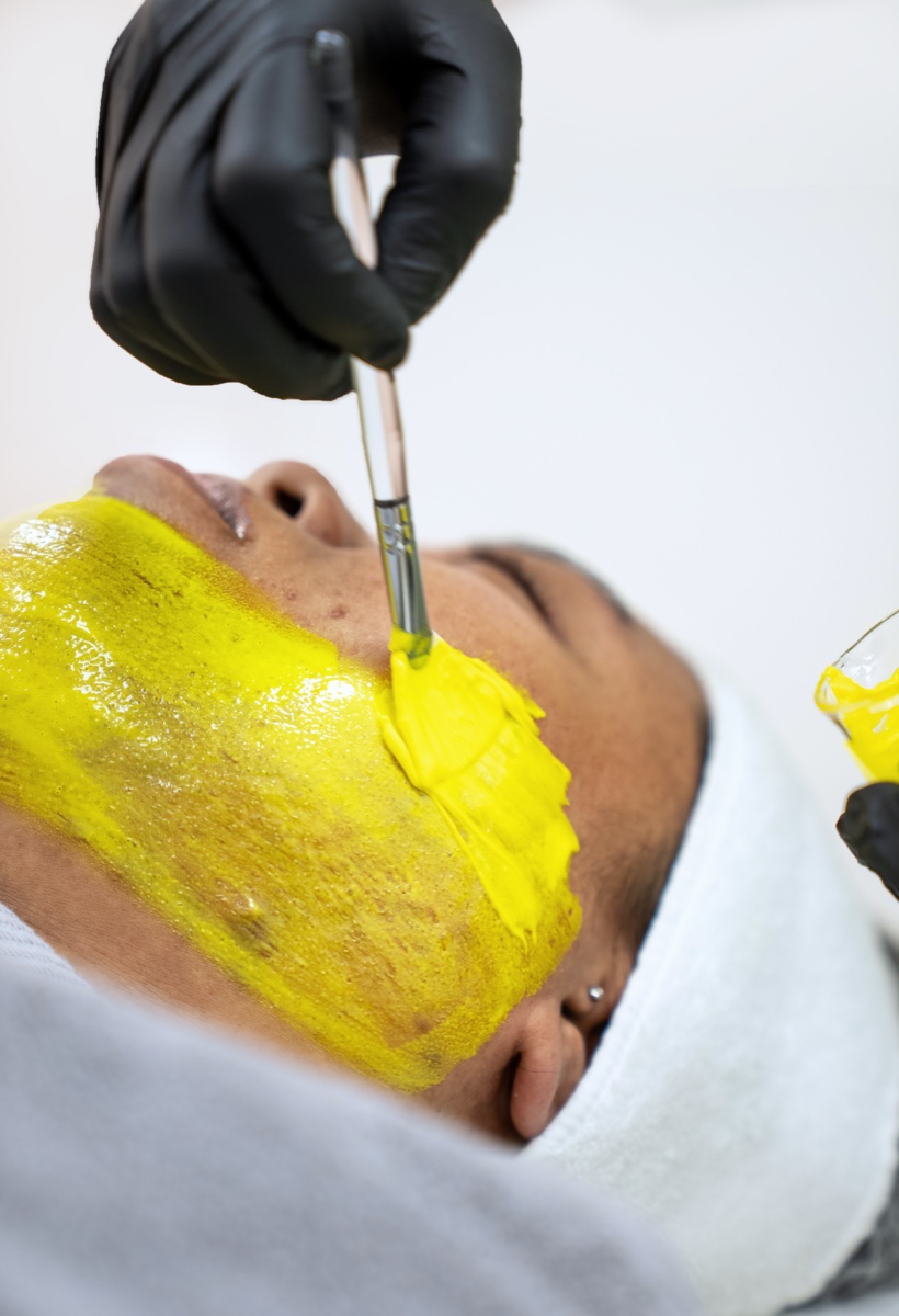 Medical grade chemical peel treatment for skin rejuvenation in Abu Dhabi