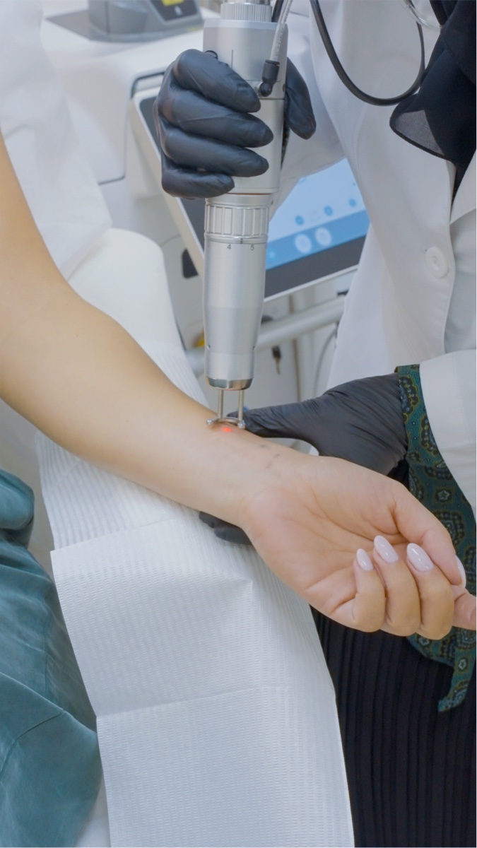 Laser tattoo removal treatment in Abu Dhabi